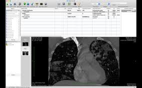 Is there a free version of jivex dicom viewer? Top 12 Free Open Source Dicom Viewers And Pacs Workstations For Macos