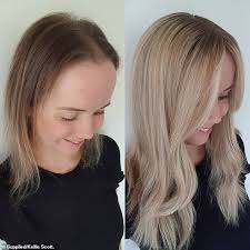 Woman 33 Reveals How She Lost 70 Per Cent Of Her Hair After Switching Contraceptive Pill Daily Mail Online