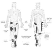 We think this is the most useful anatomy picture that you need. Lower Body Diagrams Lzr Ultrabright Powerful Led Therapy