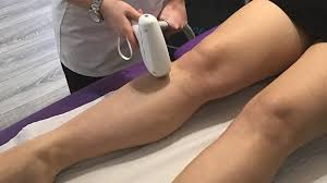 Medical aesthetics & laser is a med spa in woodlands tx. Laser Hair Removal Liverpool