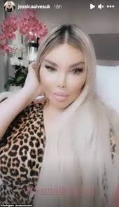 Jessica, formally known as rodrigo, and has altered her appearance to look like a. Jessica Alves Reveals She Had Sex Reassignment Surgery In Bangkok Oltnews