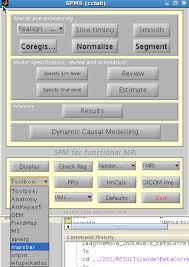 This could be the result of the dia work processes are fully utilized. Andy S Brain Blog