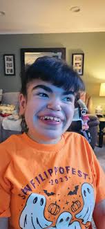 Emily's Dance, our baby's life with San Filippo Syndrome