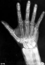 Gonna Get Creative With Noah S Cast Hope It Works Xray Art X Ray Art Class