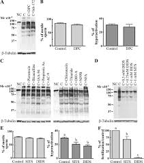 At exl, people are our biggest asset. Chloride Is Essential For Capacitation And For The Capacitation Associated Increase In Tyrosine Phosphorylation Journal Of Biological Chemistry
