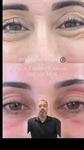 🦷✨ Conheça o Dr. Mateus Ataide, nosso especialista em implantes dentários  na COI Saúde de Amargosa e Mutuípe! 🌟 No vídeo de hoje, o Dr. Mateus fala  um pouco sobre os benefícios