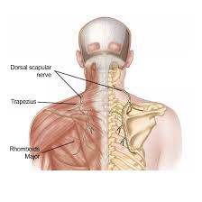 This movie shows a typical left upper lobectomyc ase starting with port placement, a deep nodule excision, and a usual sequence of hilar structure anatomic division. Unilateral Scapular Pain Leading To Er Visit Posture