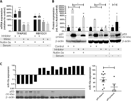 Check spelling or type a new query. Mir 10a As A Therapeutic Target And Predictive Biomarker For Mdm2 Inhibition In Acute Myeloid Leukemia Leukemia