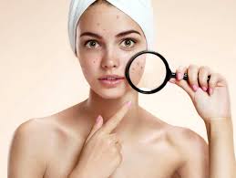 Removing dark spots from the face is a slow process. How To Treat Dark Spots At Home The Times Of India