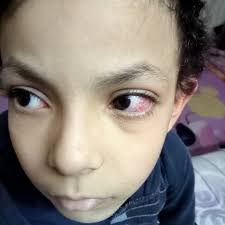 أولياء أمور مدارس مصر