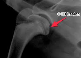 Shoulder Osteochondritis Dissecans In Pets Dogs And Cats