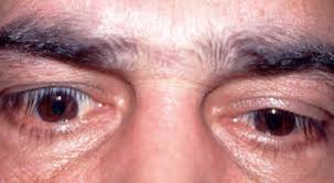 Lid lag on wn network delivers the latest videos and editable pages for news & events, including entertainment, music, sports, science and more, sign up and share your. Part 2 Of Whitney Fnp Flashcards Quizlet