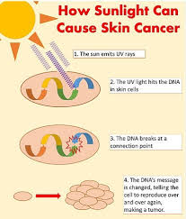 To revisit this article, visit my profile, thenview saved stories. How Is Skin Cancer Caused Quora