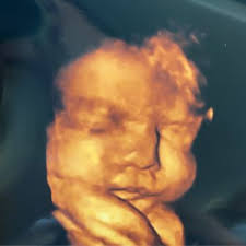 TOP 10 BEST 3d Ultrasound in Saint Louis, MO