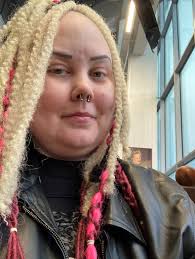 Hemipleginen migreeni ei estä Suzannea elämästä