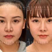 DONALD B YOO, MD, FACS