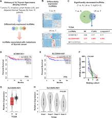 Because there's such a wide range of thyroid cancers with varying degrees of aggression, how the cancer is. Lncrna Slc26a4 As1 Suppresses The Mrn Complex Mediated Dna Repair Signaling And Thyroid Cancer Metastasis By Destabilizing Ddx5 Oncogene