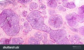 660 Budding Breast Royalty-Free Images, Stock Photos & Pictures |  Shutterstock