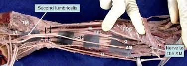 • fds & fdp tendons of each finger pass through a fibroosseous tunnel which comprises 5 also assist fdp indirectly during hand closure. Photograph Shows The Ventral View Of The Right Forearm And Hand Download Scientific Diagram
