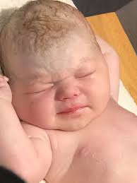 Some photos and videos from the ultrasound today 🥰 technology is amazing!