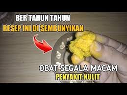 Dokter Kulit Terkejut Cara Mengobati Penyakit Eksim Kulit Obat Penyakit Kulit Eksim Ampuh Youtube Obat Alami Kesehatan Alternatif Eksim