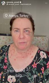 AnneMa Yuvali, Tyrkia