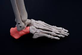 Maybe you would like to learn more about one of these? What Are Bone Spurs