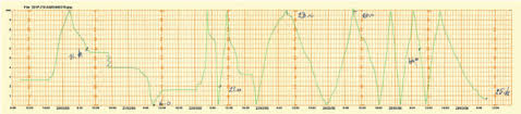 Example Of Rain Gauge Recorder Chart Download Scientific