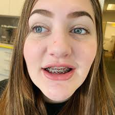 The Full House Lymans