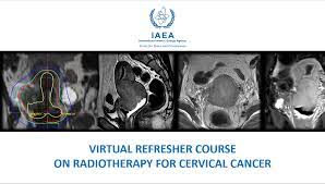 Cervical most cancers is most cancers that develops inside the region around the outlet of the cervix. Iaea Conducts Cervical Cancer Radiotherapy Educational Sessions For Morocco Iaea