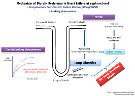 Image result for Diuretic