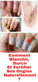 Dedoubles Cassants Secs Mous Ou Manque De Blancheur Nos Ongles Ont Aussi Besoin D Attention Alors Pour Chouchouter Un Peu S You Nailed It Nails Us Nails
