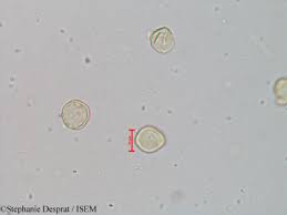 Image result for Aporrhiza paniculata