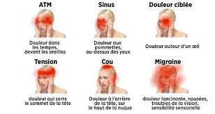 Xuye la musique est trop forte : Apprenez A Reconnaitre Les Maux De Tete Dangereux Circulaire En Ligne