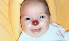 Smiles better...op puts grin