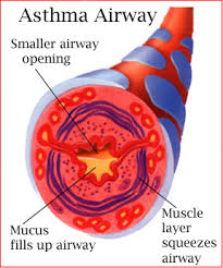 Older children and adults can perform lung function tests to check the health of their airways. All About Asthma Asthma Initiative Of Michigan Aim