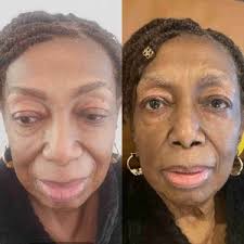 Keratin Treatment Near Me: Glen Burnie, MD