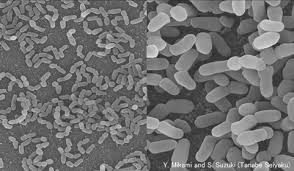 Image result for Rhodococcus equi