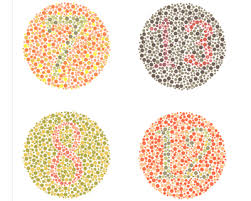 Andweakness 1 12 12 12 2 8 3 x 3 6 5 x 4 29 70 x 5 57 35 x 6 5 2. How Color Blindness Is Tested American Academy Of Ophthalmology