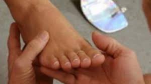 A inceput sa ma manance si pielea, in principal mainile, pe partea de sus, dar fara sa am eruptii sau semne vizibile pe piele. Cum Si De Ce Trebuie Sa Scapam Cat Mai Repede De Ciuperca Piciorului Mobile