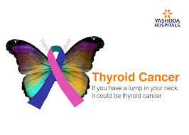 Is lung cancer in your neck and can you feel it. answered by dr. If You Have A Lump In Your Neck It Could Be Thyroid Cancer