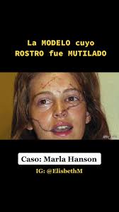 Marla Hanson Now in 2024