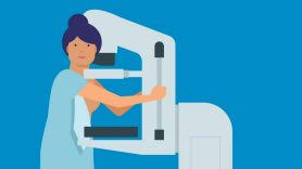 Intuitive products redefining what mri can be. Mammograms Breast Cancer Screening Md Anderson Cancer Center