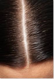 This can be avoided by following hair dye instruction properly. Sensitive Souls With Sensitive Scalps And Using Hair Color Sensitive Scalp Scalps Hair Color