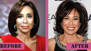 During her fight for the us senate seat from new york state in 2006, she lost page 10 of her speech papers and stood silently on the stage for 32 seconds. Jeanine Pirro Plastic Surgery Botox Facelift Cheek Fillers Lip Fillers