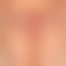 Боли и дискомфорт во время менструации