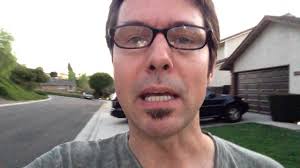 My L5-S1 Microdiscectomy Story