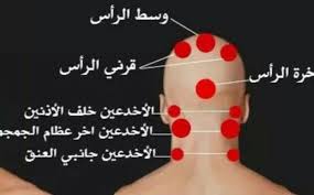 فوائد الحجامة في وسط الرأس مركز وقاية للحجامة بالكويت الحجامة بالكويت حجام بالكويت