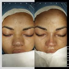 Ethnic Nose By Drboraok