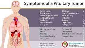 Pituitary Gland Is A Small Endocrine Gland Situated Just Below The Brain Know More About The Sympt Pituitary Gland Tumor Pituitary Gland Brain Tumor Awareness